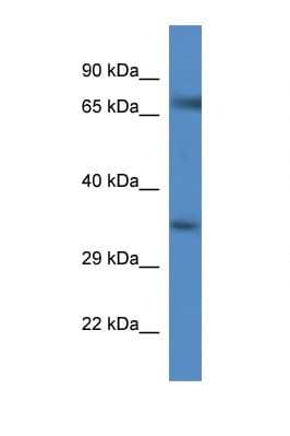 SLC6A9 / GLYT1 Antibody (aa557-606)
