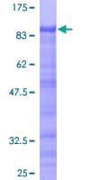 Human ZKSCAN3 / ZNF306 Protein (Recombinant GST)
