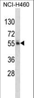 FTO Antibody (aa1-30)