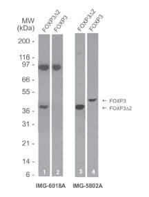 FOXP3 Antibody (clone 16J4G6)