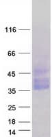 Human OSCAR Protein (Recombinant Myc-DDK (Flag))