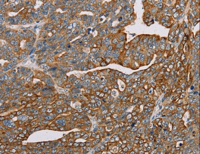 MTFP1 Antibody