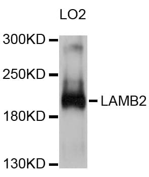 IHC-plus™ LAMB2 / Laminin Beta 2 Antibody (aa1579-1798)