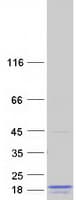 Human LIMD2 Protein (Recombinant Myc-DDK (Flag))