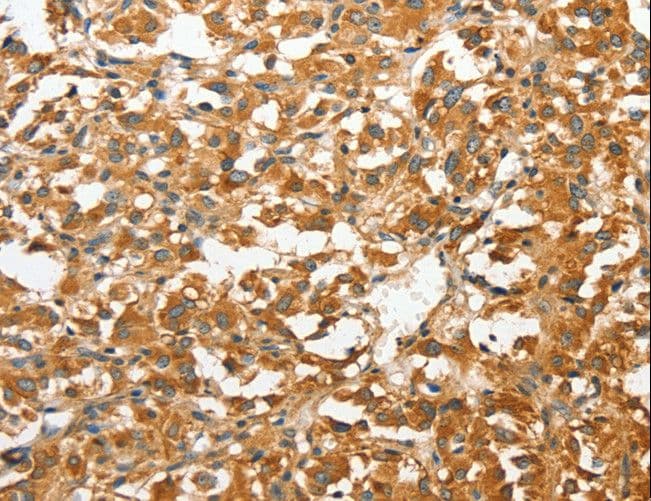 ANXA9 Antibody