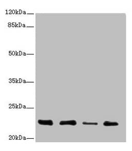TNFAIP8 / SCC-S2 Antibody