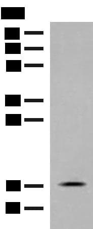 RPS25 / Ribosomal Protein S25 Antibody