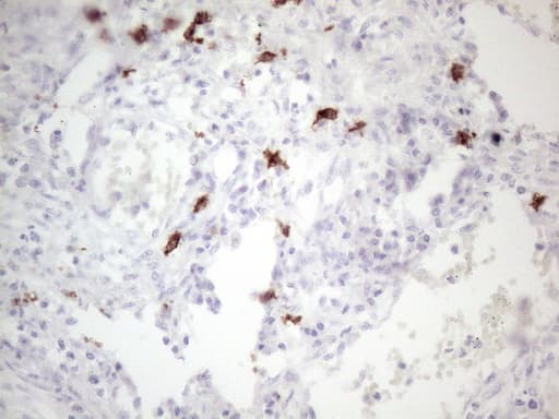 Monoclonal Mouse anti-Human c-Kit / CD117 Antibody (clone OTI2B12, aa27-308, IHC, WB)