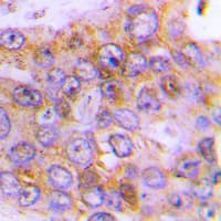 ARSD / Arylsulfatase D Antibody (Internal)