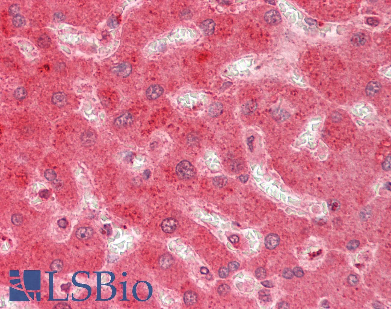 Polyclonal Rabbit anti-Human APOE / Apolipoprotein E Antibody (aa81-130, IHC, WB)