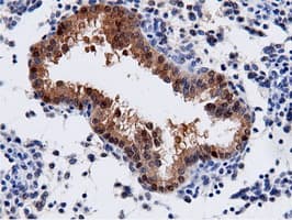 AK5 / Adenylate Kinase 5 Antibody (clone OTI2A2)