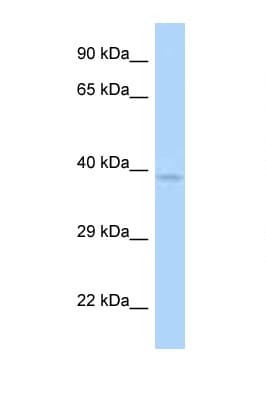 ANKRD9 Antibody (C-Terminus)