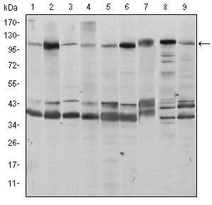 FUK Antibody (clone 600)