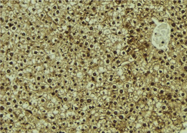 CMIP Antibody