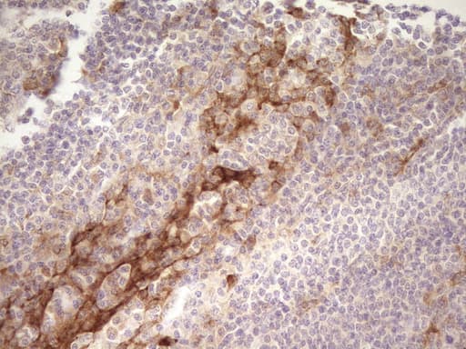 GPNMB / Osteoactivin Antibody (clone OTI8A10)