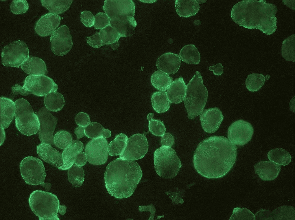 HSV-1+2 gB Antibody (clone T111)
