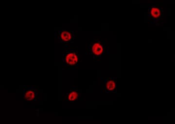 HDAC1 Antibody (phospho-Ser421)