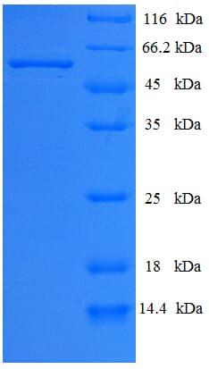 Pig CAPN2 / Calpain 2 / M-Calpain Protein (Recombinant His-SUMO)