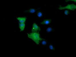 Monoclonal Mouse anti-Human MAP2K1 / MKK1 / MEK1 Antibody (clone OTI3E6, IHC, IF, WB)
