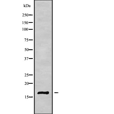 CST6 / Cystatin E/M Antibody