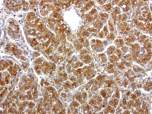 HP / Haptoglobin Antibody (clone UMAB10)