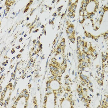 Polyclonal Rabbit anti-Human HSPA9 / Mortalin / GRP75 Antibody (IHC, IF, WB)