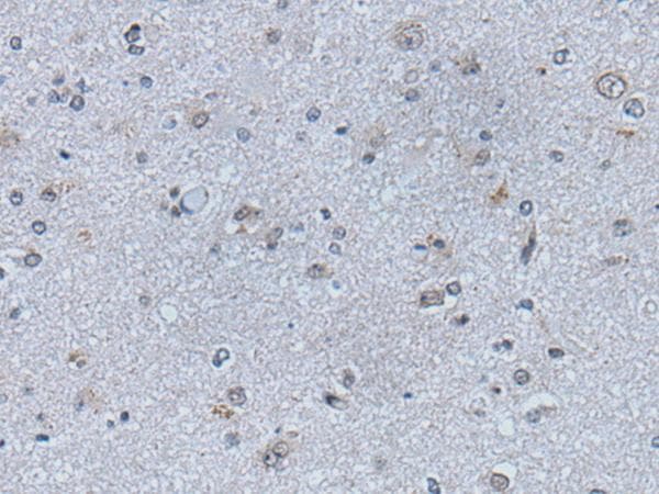 EFNB1 / Ephrin B1 Antibody