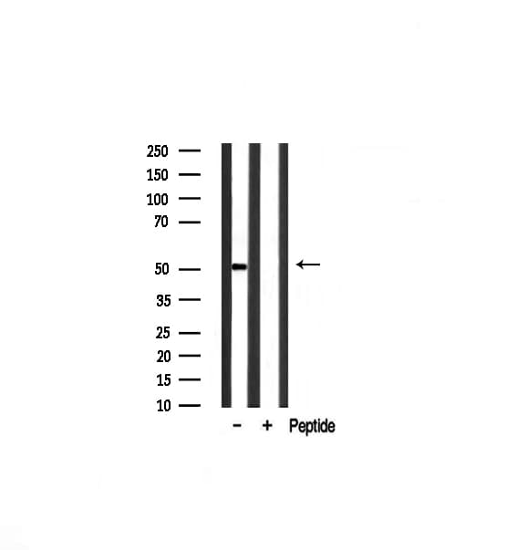 EGR2 Antibody