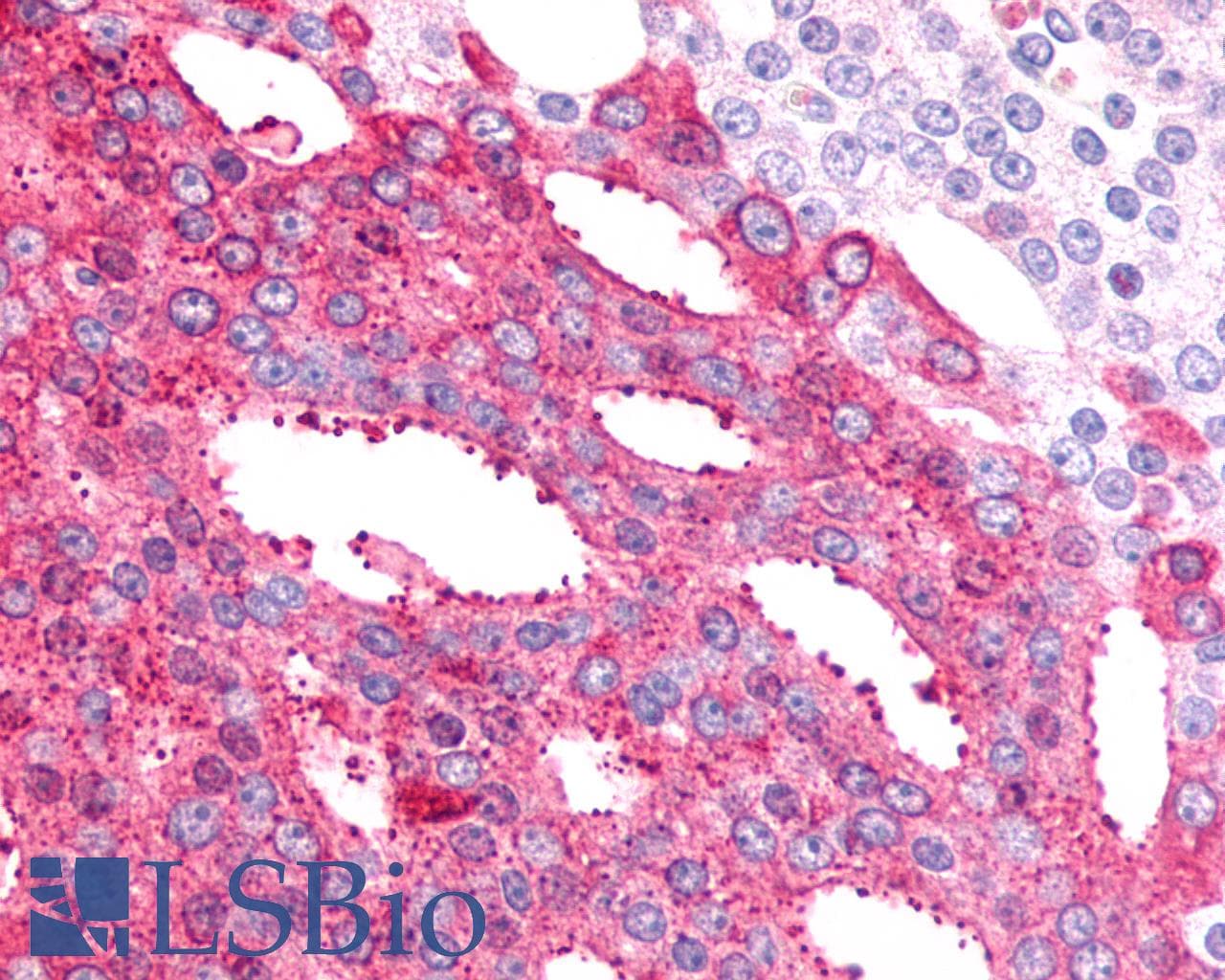 PathPlus™ ADGRB2 / BAI2 Antibody (N-Terminus)