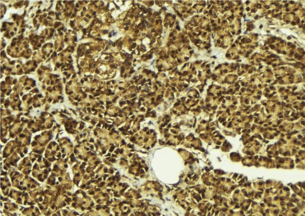 Polyclonal Rabbit anti-Human AF5Q31 / AFF4 Antibody (IHC, WB)