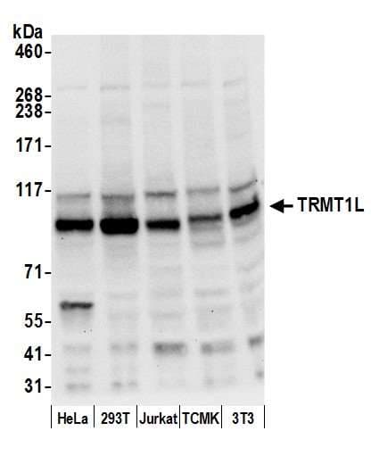 TRMT1L Antibody (aa1-50)