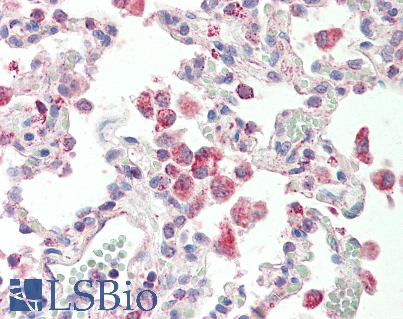 IHC-plus™ GLRA1/Glycine Receptor Alpha 1 Antibody (aa373-386)