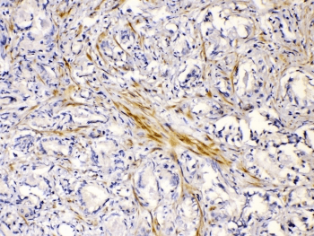 CHRNA5 Antibody