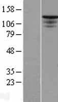 HTS1 / ST5 Protein (Over-Expression Lysate Myc-DDK (Flag))
