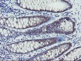 Monoclonal Mouse anti-Human DPH2 Antibody (clone OTI1A12, IHC, WB)