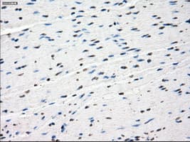 SSX2 Antibody (clone OTI4A11)