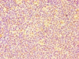 Polyclonal Rabbit anti-Human CASP6 / Caspase 6 Antibody (aa24-293, IHC, WB)