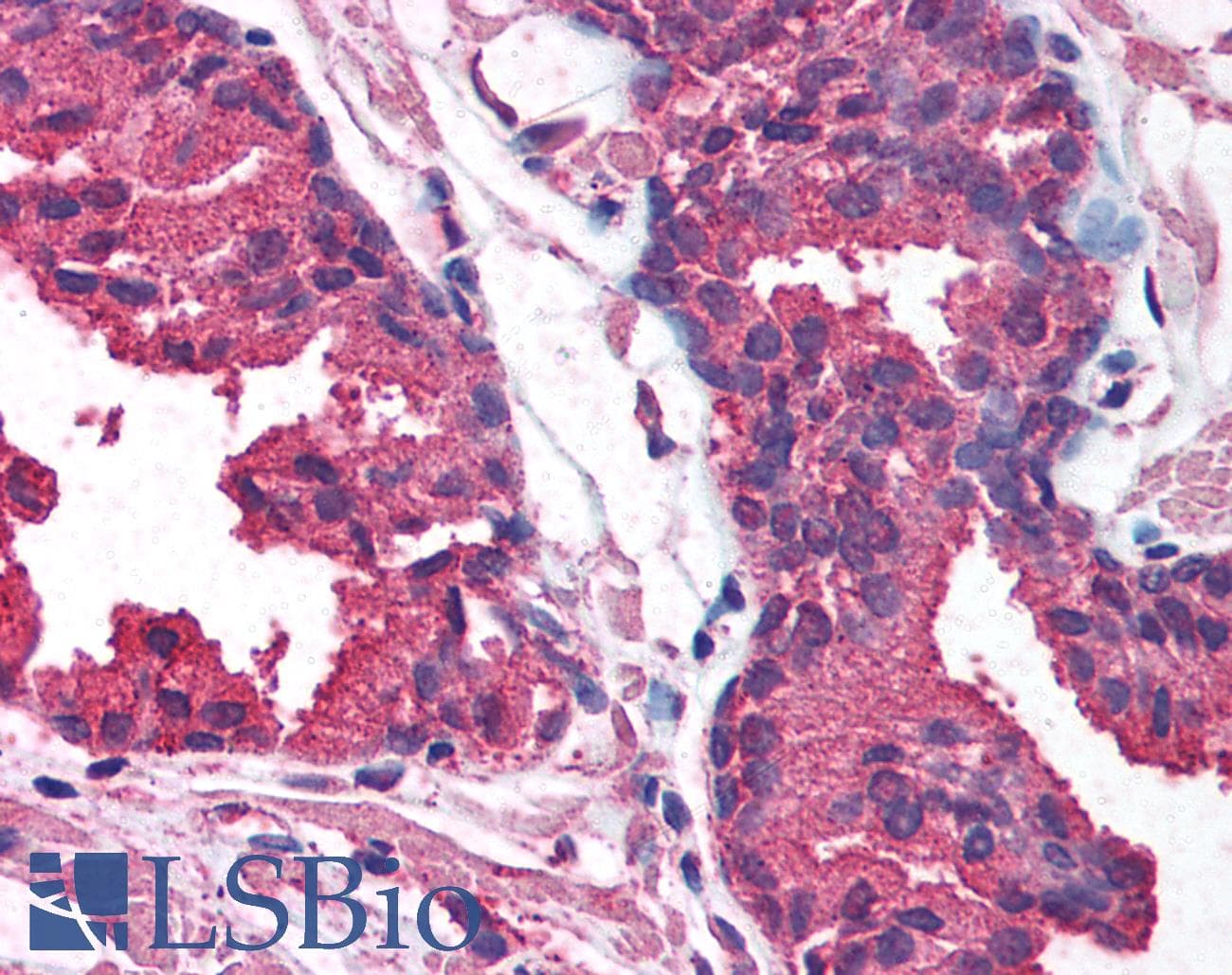 AKT1 Antibody (aa121-170)