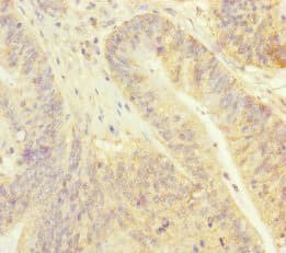 Polyclonal Rabbit anti-Human PSF1 / GINS2 Antibody (IHC)
