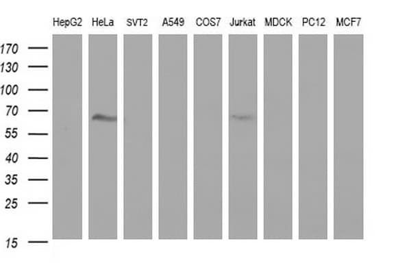 FGG / Fibrinogen Gamma Antibody (clone OTI5D7)