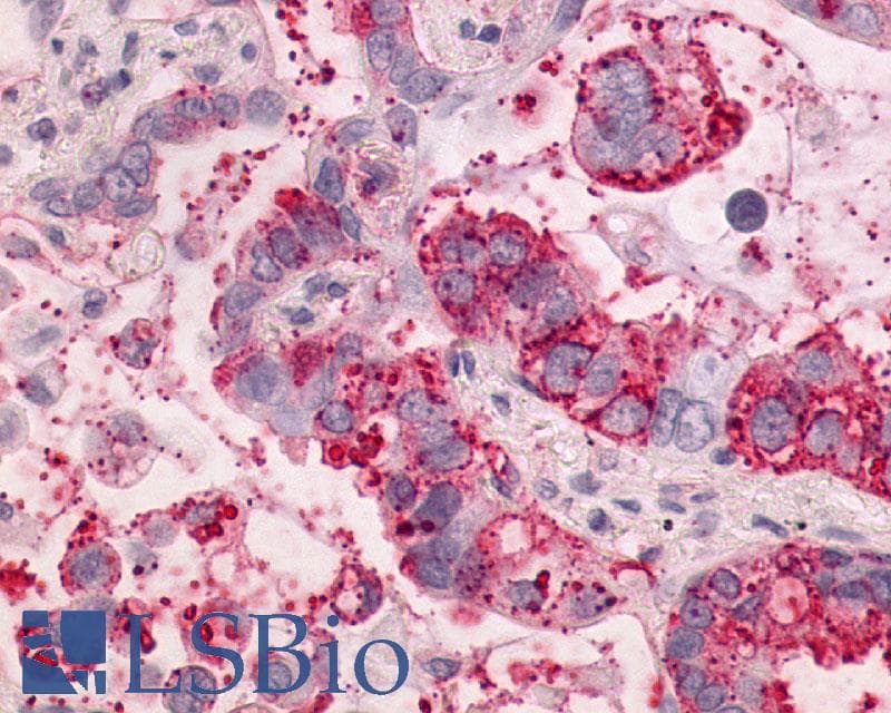 PathPlus™ NTSR1 / NTR Antibody (Cytoplasmic Domain)