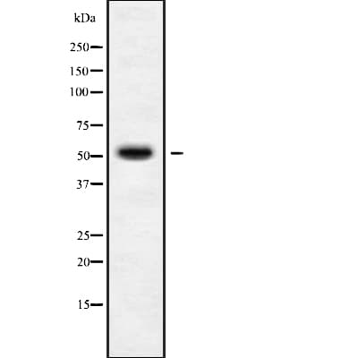 STK38L / NDR2 Antibody