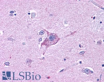 IHC-plus™ Polyclonal Rabbit anti-Human NPY5R Antibody (Cytoplasmic Domain, IHC)