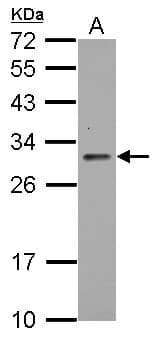 TIGAR Antibody