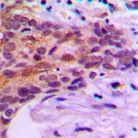 Polyclonal Rabbit anti-Human MOB1B / MOBKL1A Antibody (Internal, IHC, WB)