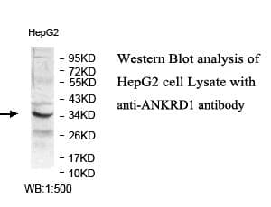 CARP / ANKRD1 Antibody (aa50-281)