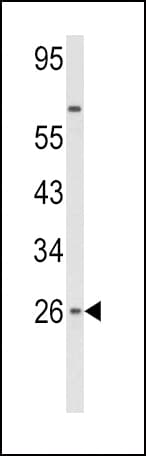 IFN Beta / Interferon Beta Antibody (aa39-66)