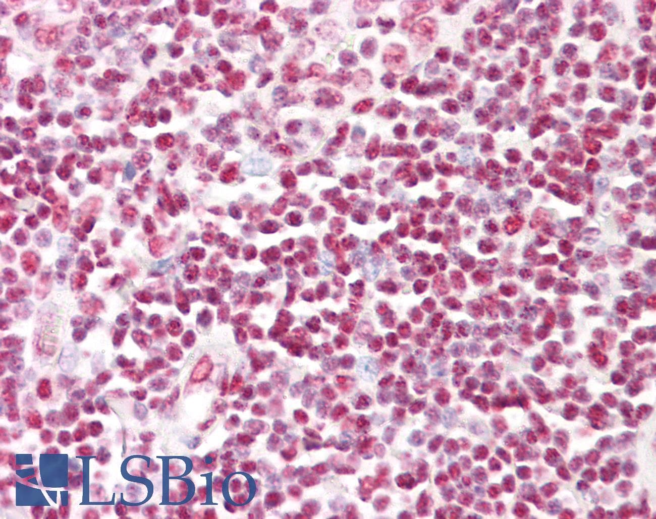 IHC-plus™ HNRNPD / AUF1 Antibody (aa49-98)