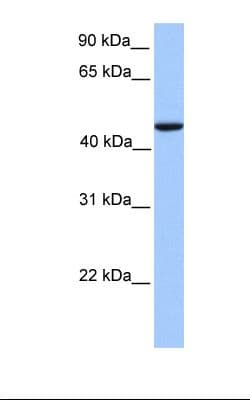 Polyclonal Rabbit anti-Human REXO4 / MPMC2 Antibody (aa201-250, WB)