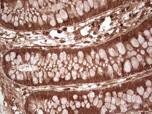 UBE2D2 / UBCH5B Antibody (clone OTI1D11)